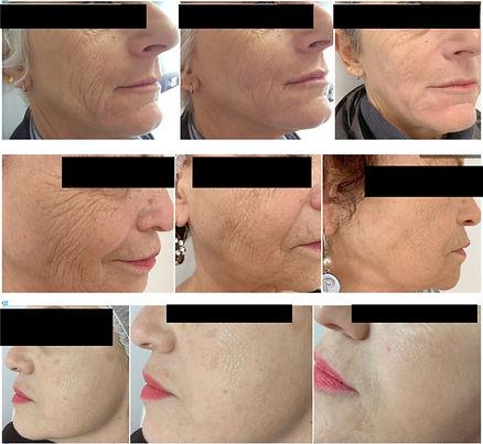 Inflammation, Stress & Skin Ageing — The Hertfordshire Regeneration Reset