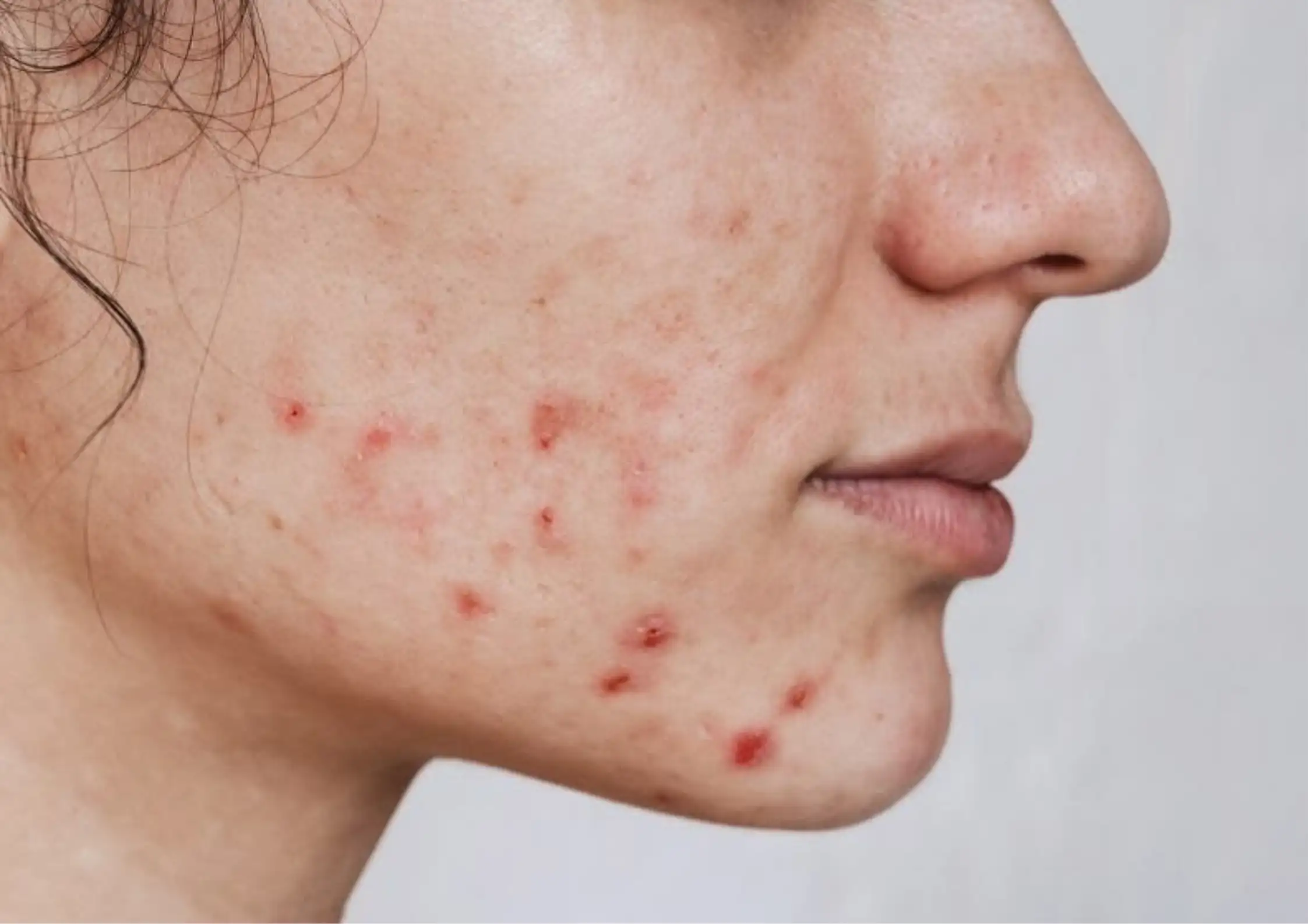 Why Treatments Fail: When Skin Is Not Ready for Correction